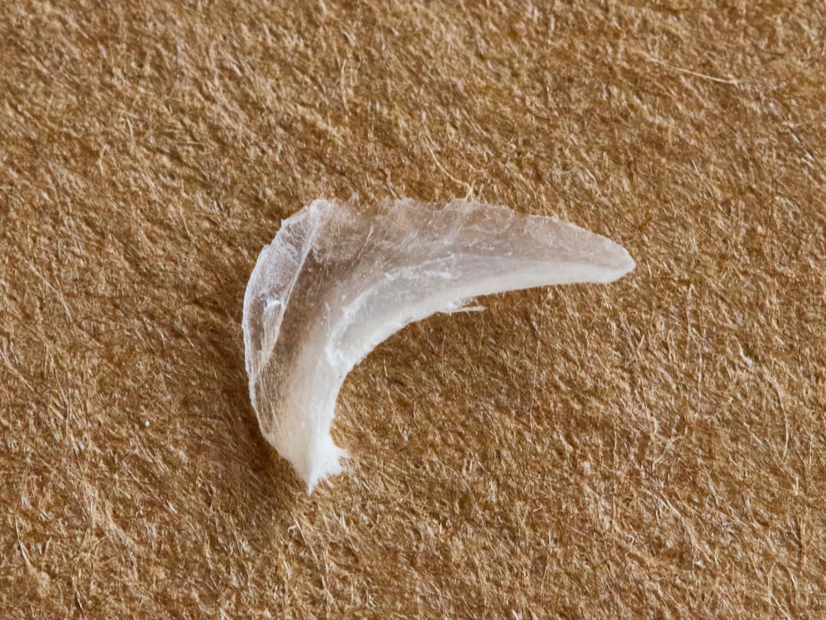 猫の爪の多層構造